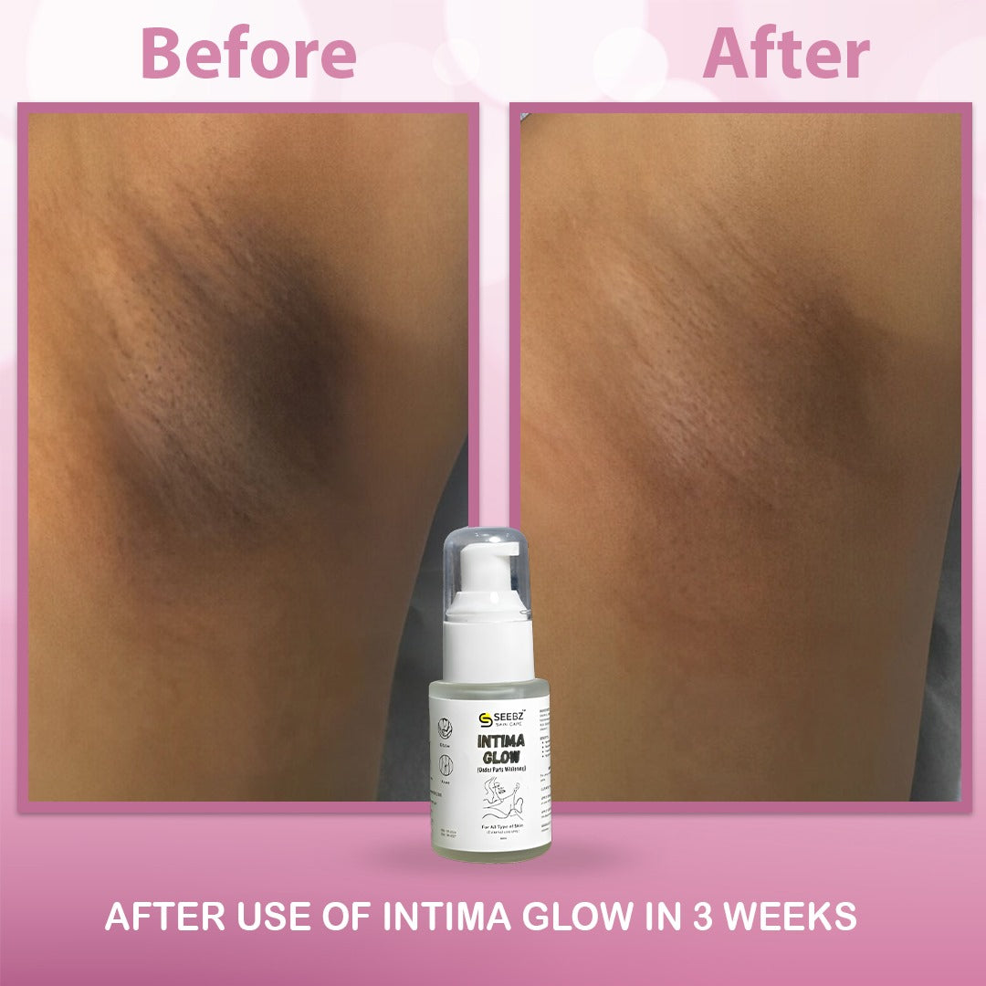 INTIMA GLOW -