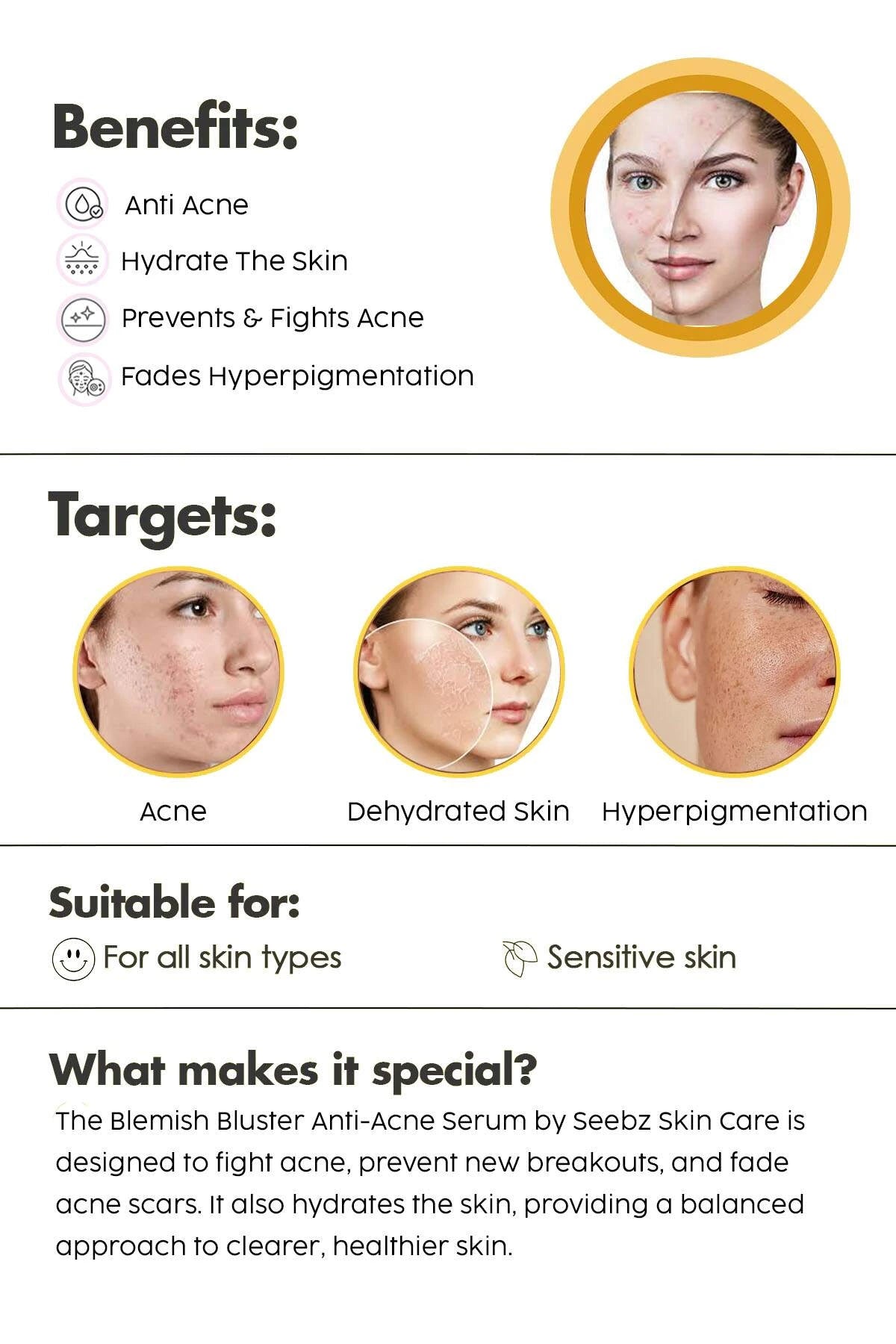 Blemish Buster-Anti Acne