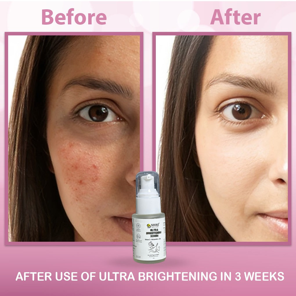 Ultra Brightening Serum-Vitamic C