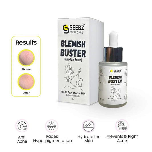 Blemish Buster-Anti Acne